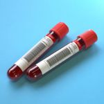 lab test image