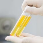 lab test image