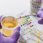 lab test image