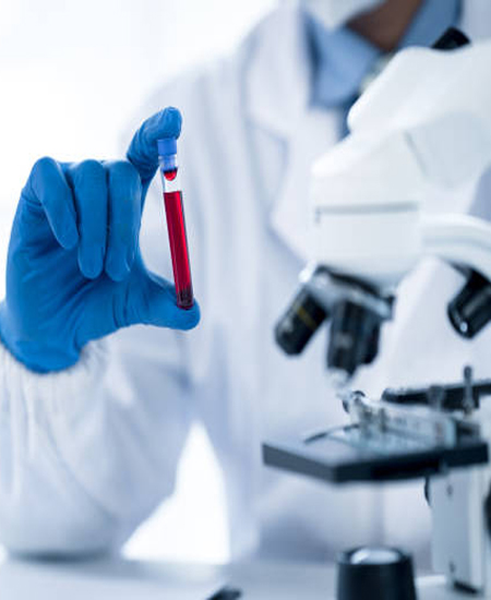 lab test image