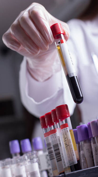lab test image