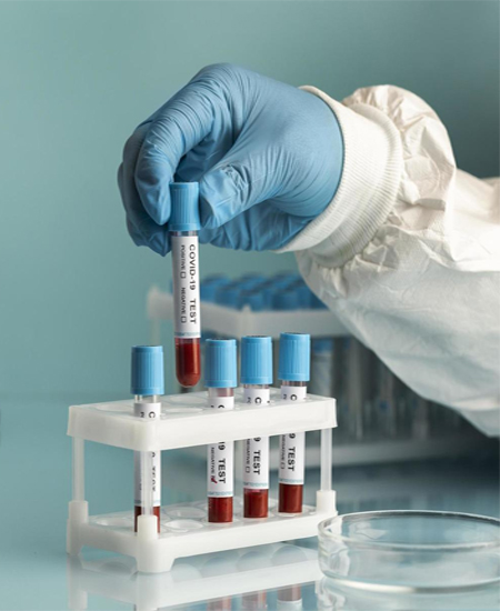 lab test image